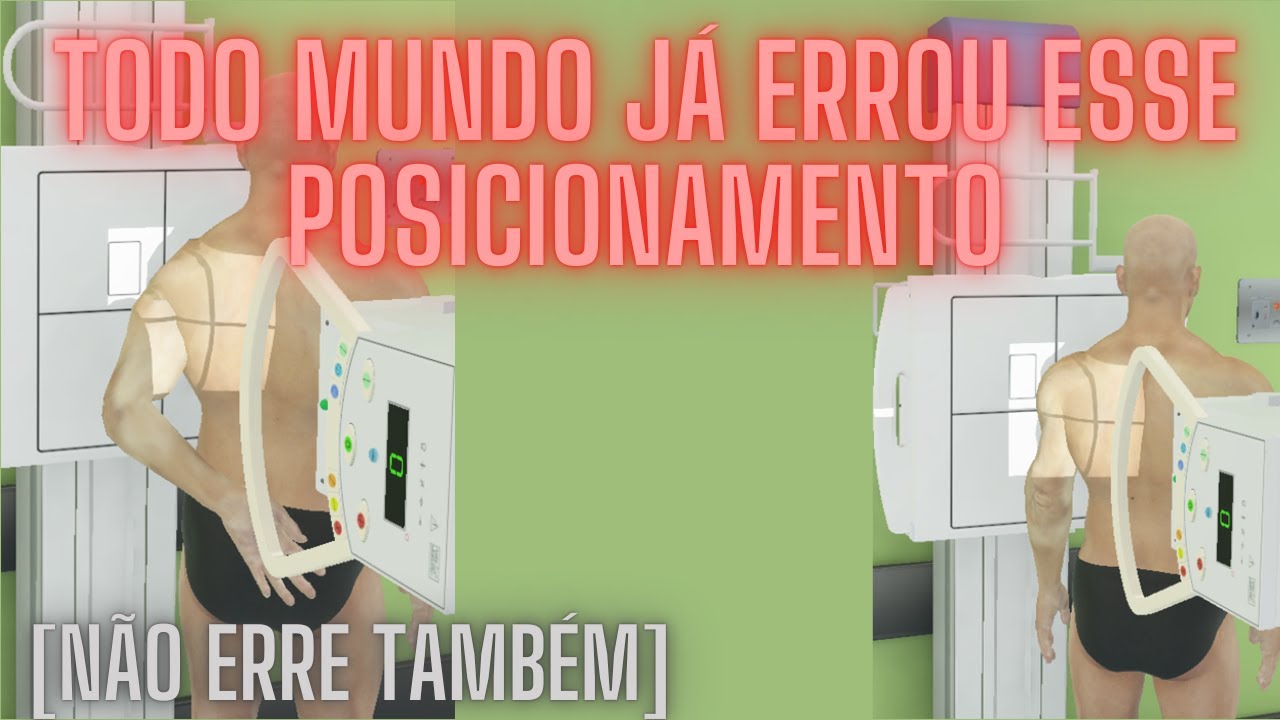 [RADIOGRAFIA] Y ESCAPULAR E NEER