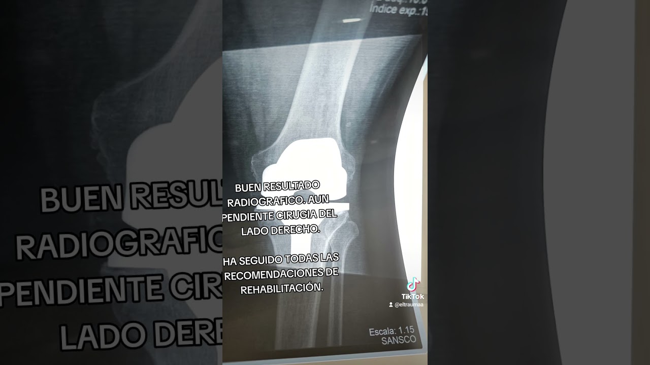 Jorge Luis Martínez Navarro-16