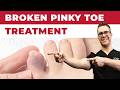 What To Do For A Broken Pinky Toe [How To Tape & Little Toe Treatment]