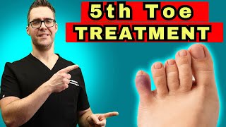 What To Do For A Broken Pinky Toe [How To Tape &amp; Little Toe Treatment]