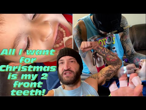 My son lost his first baby tooth vlog
