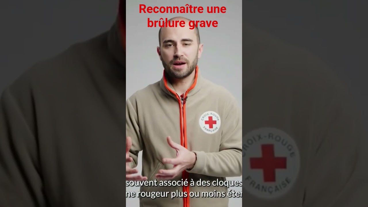 Comment reconnaître une brûlure grave ? #shorts