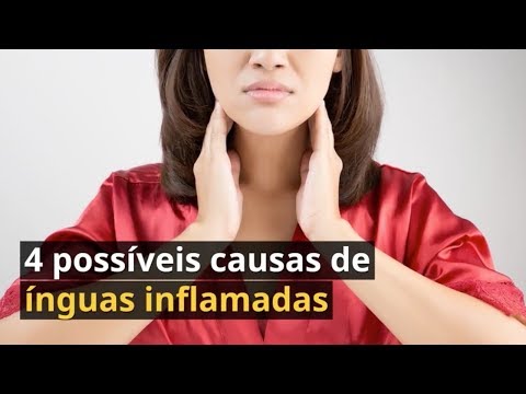 Imagem ilustrativa do vídeo