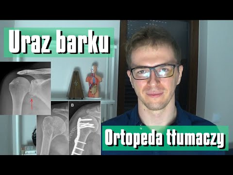 KONTUZJA BARKU - ZWICHNIĘCIE, ZŁAMANIE, URAZ. Lekarz tłumaczy.