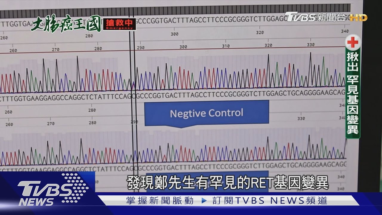「新癌王」大腸癌跟「它們」有關　愛將菜飯「這樣做」恐成罹癌危險因子