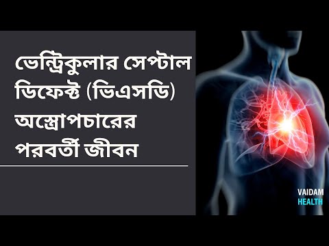 ভেন্ট্রিকুলার সেপ্টাল ডিফেক্ট ভিএসডি অস্ত্রোপচারের পরবর্তী জীবন