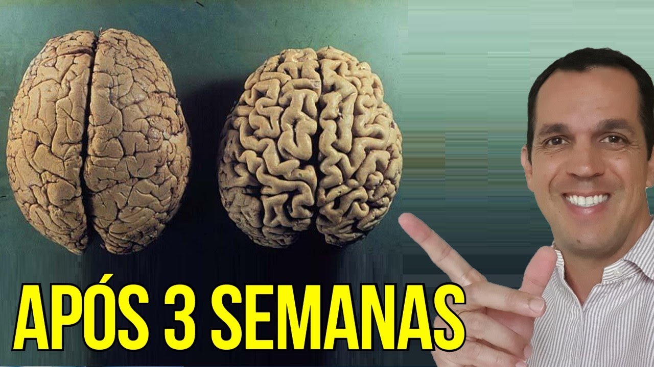 Watch Now MAGNÉSIO TREONATO | O QUE ACONTECEU DEPOIS DE 3 SEMANAS DE USO MAGNÉSIO TREONATO | O QUE ACONTECEU DEPOIS DE 3 SEMANAS DE USO