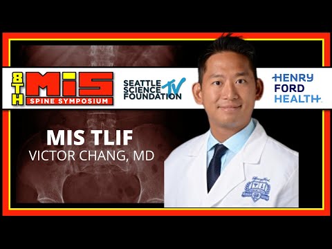 MIS TLIF - Victor Chang, M.D.