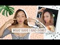 WHAT I'VE HAD DONE & WAS IT WORTH IT? | Botox, Filler, Mole removal