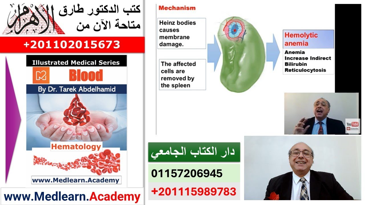 G6PD Deficiency [Favism]   #cme #internal_medicine #medical #usmle #محاضرات_باطنة #USMLE