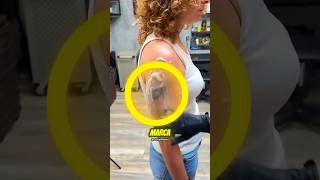 ¡ESCONDIÓ ESTA MARCA DURANTE AÑOS! 😢 #tattoo #birthmark #transformation