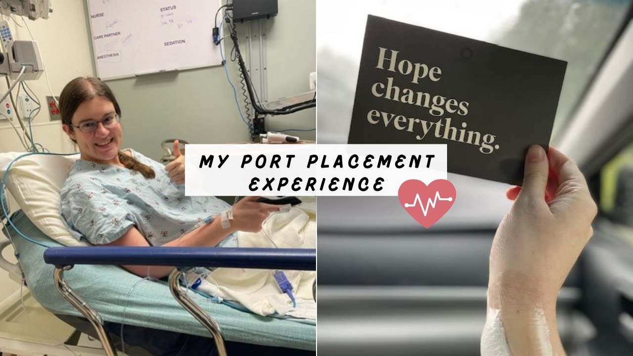 VLOG: My Port Placement Experience