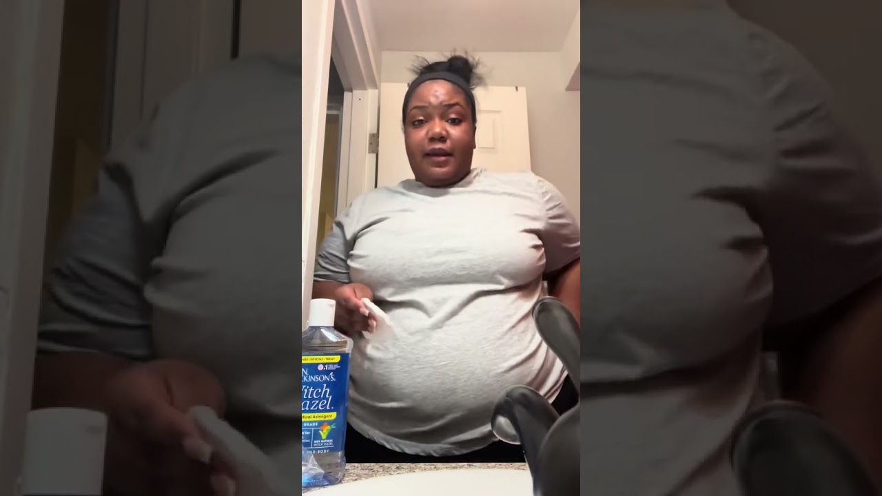 STAY FRESH ALL DAY USING WITCH HAZEL‼️ #Tips #HowTo #Throwback