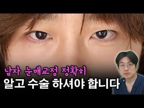 男性眼部 04