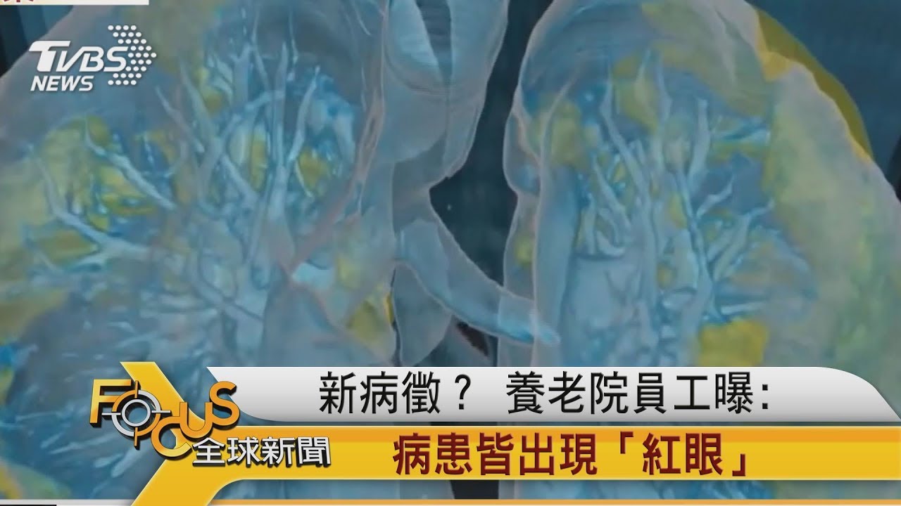 新病徵?養老院員工曝:病患皆出現「紅眼」