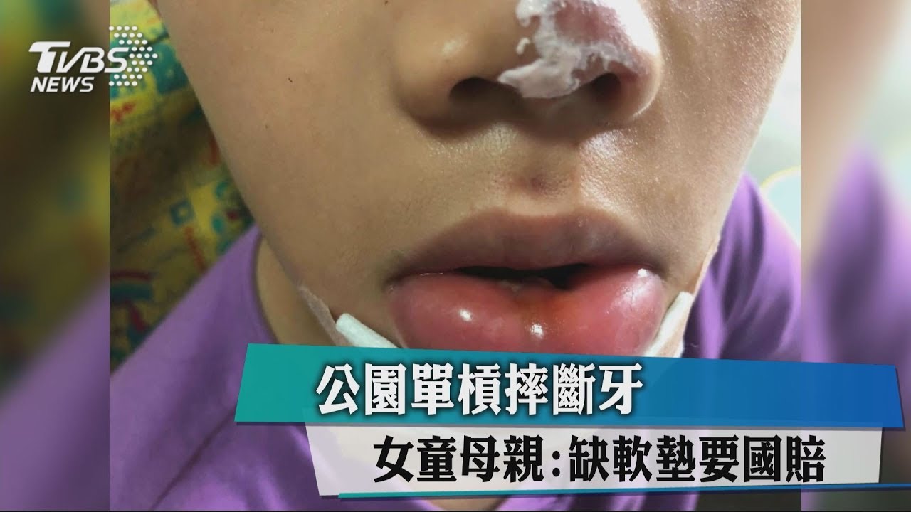 公園單槓摔斷牙　女童母親：缺軟墊要國賠