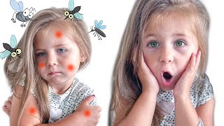 Go Away! Bad Mosquitoes | Kids Safety Tips | Nursery Rhymes | Kids Songs | Sofia vs mosquitoes |