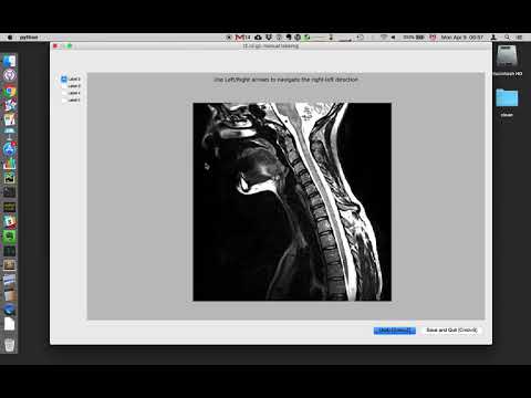 Manual vertebral labeling