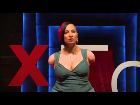Differences are beautiful | Talli Osborne | TEDxToronto
