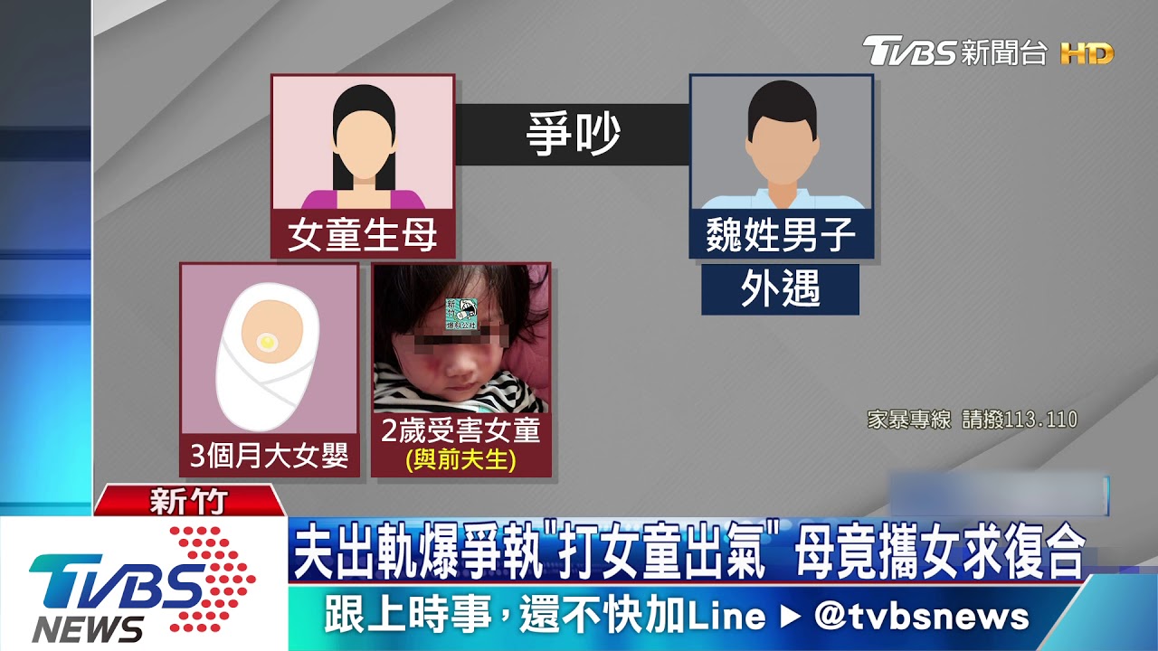 遭繼父痛毆！　2歲女慘變「熊貓眼」全身傷