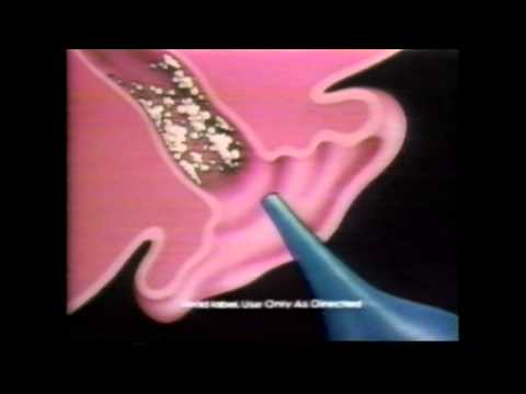 Murine Earwax Removal 1990
