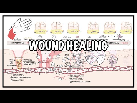 Curación de heridas: etapas de curación y patología