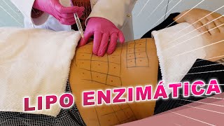 Resultados da Lipo Enzimática | Dr Luciane Bravi Explica