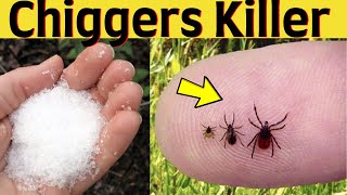 How to Get Rid Of Chiggers in Your Home, Yard, and Bed Naturally