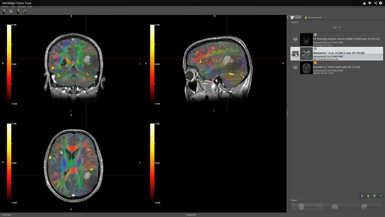 BrainMagix Fusion Tools
