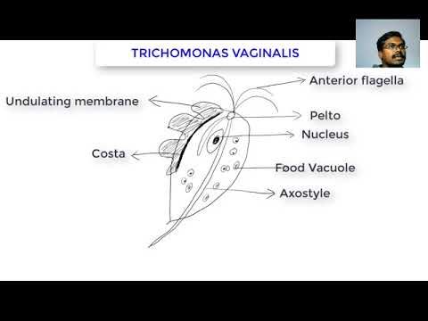 a Trichomonas férfiak következményei