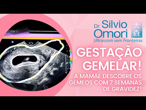 Gestação gemelar! A mamãe descobre os gêmeos com 7 semanas de gravidez!