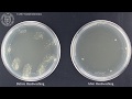 Bacteria before and after washing hands