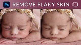 Remove Flaky Skin From Face In Photoshop
