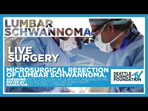 Microsurgical Resection of Lumbar Schwannoma