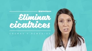 Eliminar cicatrices. Cremas y remedios.