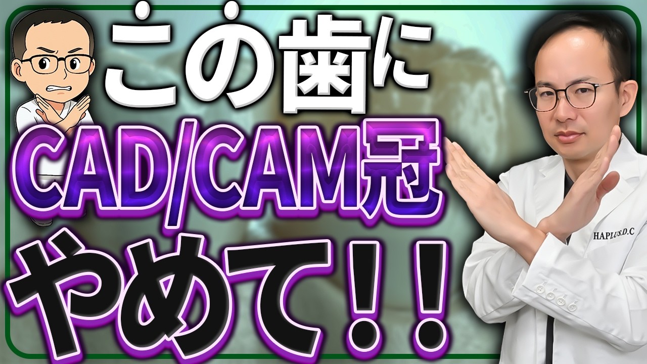 【部位別】保険治療のおすすめ素材はこれ！全部CAD/CAM冠ではダメな理由は...？