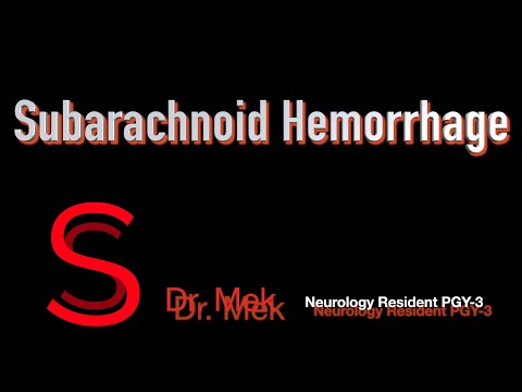 Strike Stroke with Dr. Mekdes: Subarachnoid hemorrhage.