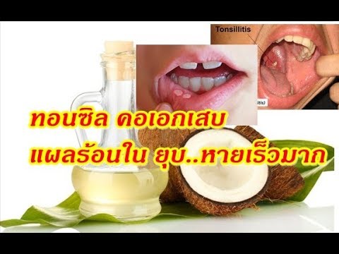 โรคสะเก็ดเงินเป็นครั้งแรก ยาต้มจากเปลือกไม้วิลโลว์กลาก