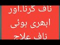 ابھری ہوئی ناف ناف گرنا ناف ٹلنا ناف میں سوجن ناف میں ہو