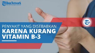 Pellagra, Disebabkan oleh Rendahnya Kadar Niasin atau Vitamin B-3 di Dalam Tubuh