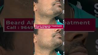How a Weekly Beard Alopecia Treatment Project Can Change Your Life. | Viral #shorts