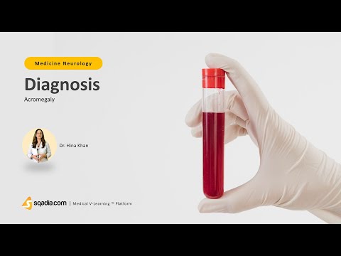 Acromegaly | Diagnosis