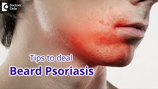 TRY AYURVEDA FOR BEARD PSORIASIS | Tips to manage Beard Psoriasis-Dr.Chaithanya KS | Doctors