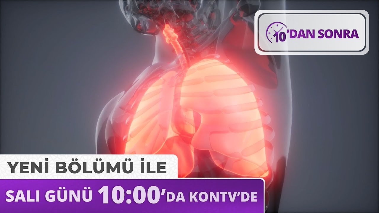 10'dan Sonra Salı 10:00'da Kontv'de