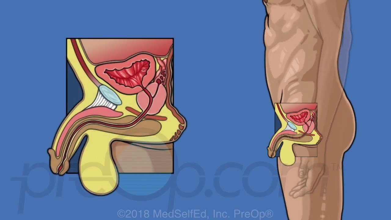 José Aguilar Moreno-8