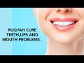 RUQYAH CURE TEETH LIPS AND MOUTH PROBLEMS DUE TO BLACK MAGIC EVIL EYE AND JINN