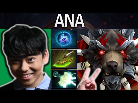 Bloodseeker Dota 2 Gameplay Miracle with 27 Kills - Linkens