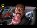 Your Lip Is Swollen The Nutty Professor