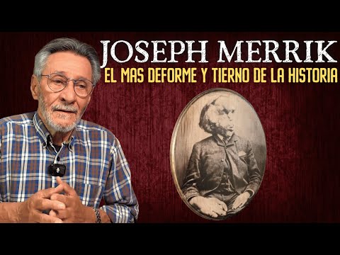 El hombre elefante | Relatos del lado oscuro
