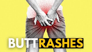 Butt Rashes:  What You Need to Know